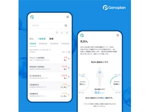 ジェノプラン遺伝子検査キット - J:COM 加入者特典・優待サービス